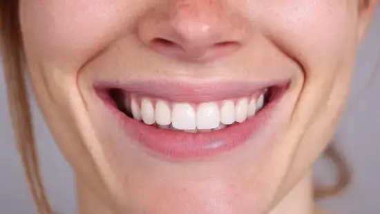 What to Expect During Orthodontic Treatment