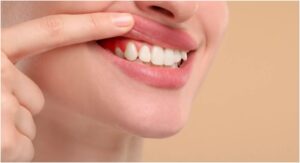The Role of Professional Dental Clinics in Laser Gum Care in Winnipeg