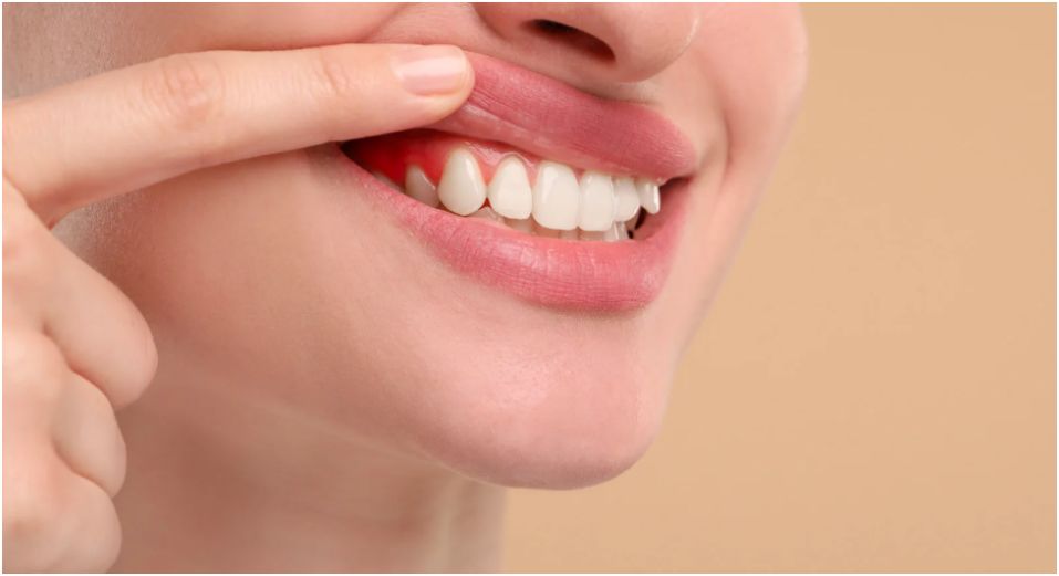 The Role of Professional Dental Clinics in Laser Gum Care in Winnipeg