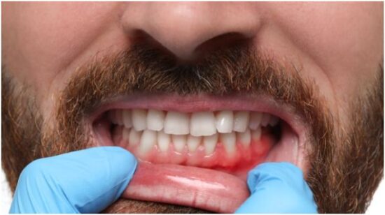 Advantages Patients Notice After Professional Treatment