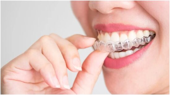 Clear Aligner Systems For Everyday Flexibility