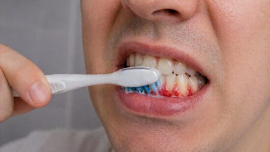 Red, Swollen, or Tender Gums