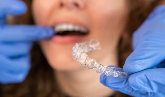 How to Choose the Right Invisalign Provider