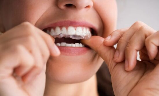 Orchard Park Dental and Implant Centre - Digital Scanning and Virtual Smile Preview